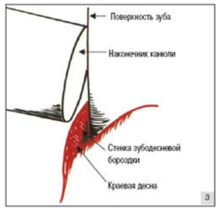 протокол нанесения